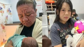 Фотография к новости: 28 жастағы әйел жүктілік кезінде ондаған жылға қартайып кетті