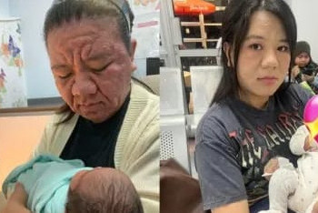 Фотография к новости: 28 жастағы әйел жүктілік кезінде ондаған жылға қартайып кетті