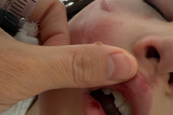 Фотография к новости: Астанада 8 жасар қыздың үстіне бассейндегі шкаф құлады