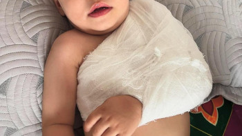 Фотография к новости: 13 жасар жеткіншек бүлдіршіннің қолын сындырды: Зәкиева түсініктеме берді