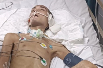 Фотография к новости: Ұлттық ұлан сарбазы Мұхтар Ербаян Түркияда емделеді