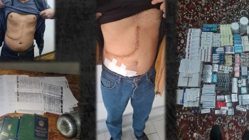 Фотография к новости: Адам ағзаларын саудалаған қылмыстық топ ұсталды