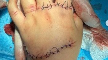 Фотография к новости: Аттракциондарда жарақат алған балалар: Сенаторлар шұғыл шаралар қабылдауды талап етті