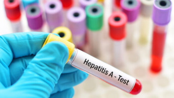 Фотография к новости: А гепатиті өршуі мүмкін: Санитарлық дәрігер мәлімдеме жасады