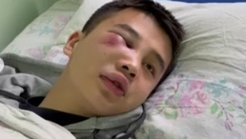 Фотография к новости: Алматыда ересектер жас жігітке жабылып, жарақаттап кеткен