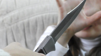 Фотография к новости: Оқушы пышақ жарақатын алды: Министрлік мәлімдеме жасады