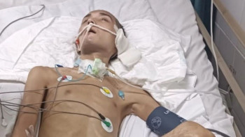 Фотография к новости: Ербаян Мұхтар толықтай сауығып кетуі мүмкін бе? – ДСМ жауабы