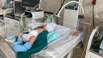 Фотография к новости: Дәрігерлер салмағы 742 грамм сәбиді аман алып қалды