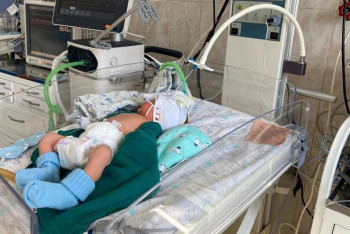 Фотография к новости: Дәрігерлер салмағы 742 грамм сәбиді аман алып қалды