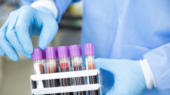 Фотография к новости: Дәрігер 50 жастан кейін әр адам білуі тиіс диагноз туралы айтты