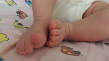 Фотография к новости: Атырауда дәрігерлер тынысы тоқтап қалған 4 айлық сәбиді құтқарды