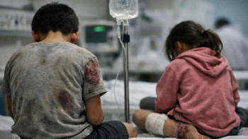 Фотография к новости: Күйік пен көгерген іздер: Шымкентте балаларды анасының қолынан алып қойды