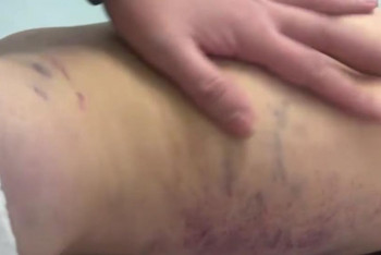 Фотография к новости: "Әлем оны әкесі соққыға жығу үшін құтқарған жоқ": Жәбірленген 3 жасар қыз туралы жаңа деректер пайда болды