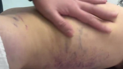 Үш жасар бала дене жарақатымен ауруханаға түсті: әкесі қамауға алынды