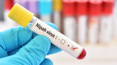 Нипах вирусынан бір адам көз жұмды