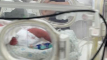 Фотография к новости: Алматы дәрігерлері салмағы 730 грамм жаңа туған сәбидің өмірін сақтап қалды