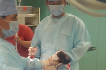 Фотография к новости: "Балалық әдет үлкен қауіпке айналды": Бойжеткеннің асқазанынан жұдырықтай шаш түйіні алынды