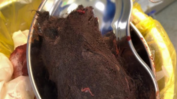 Фотография к новости: Түркістанда жасөспірімнің ішінен 1 келіге жуық шаш шықты