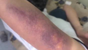 Фотография к новости: Қарағандыда бір топ жасөспірім қыз баланы соққыға жықты