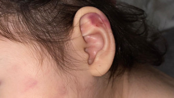 Фотография к новости: Қарағандыдағы балабақшада тәрбиеші баланы лақтырып, ұрған