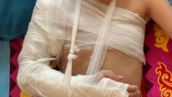 Фотография к новости: Ақтауда ойын алаңындағы темір қоршау құлап, 8 жасар бала жарақат алды