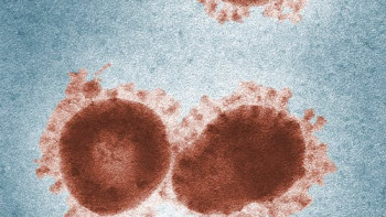 Фотография к новости: Лондонда менингит өршіді: екі адам қайтыс болды