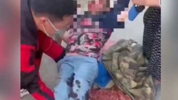 Фотография к новости: Алматы облысында мопедпен жүрген жасөспірім баланы қағып кетті