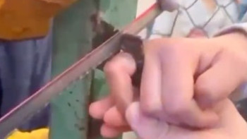 Фотография к новости: Қарағанды облысында футбол ойнап жүрген бала саусағынан айырыла жаздады