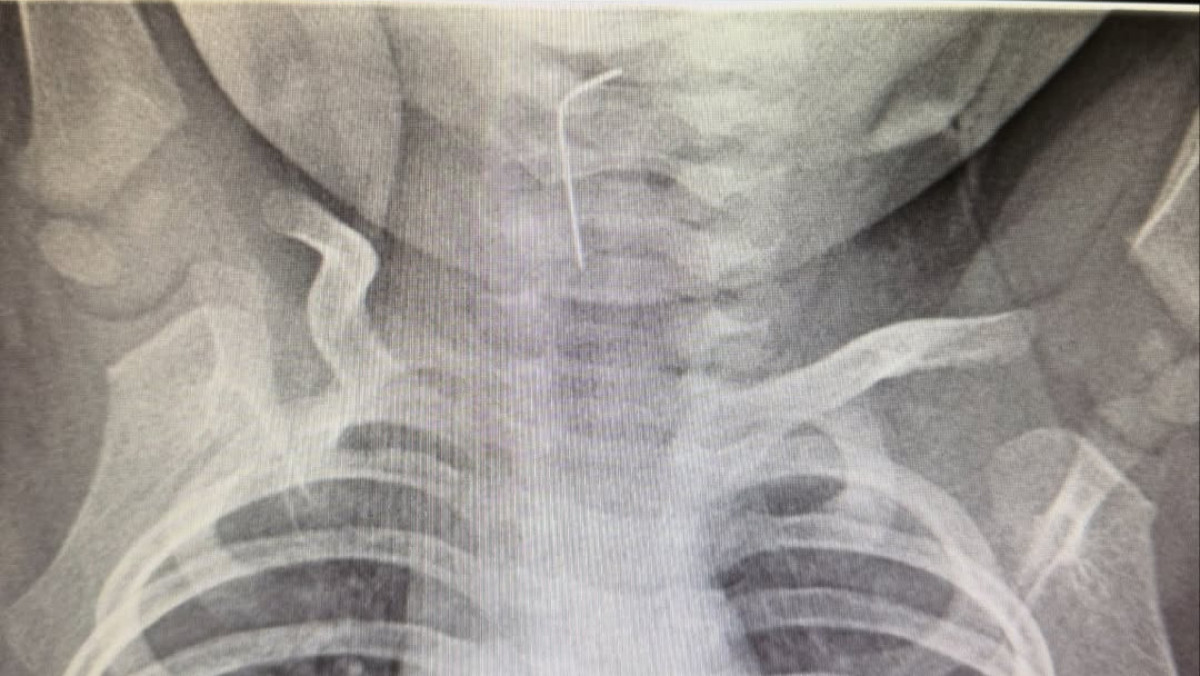  Түркістан облысының Денсаулық сақтау басқармасы