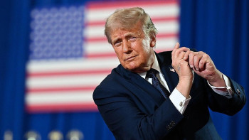 Фотография к новости: Қолы көгеріп, аяғы іскен: Дәрігерлер Трамптың денсаулығы туралы айтты
