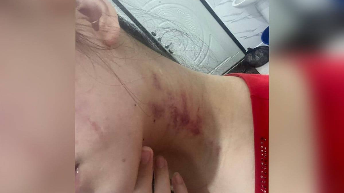 Олар әйелінің аузына сипалады, ал күйеуі оны жалайды