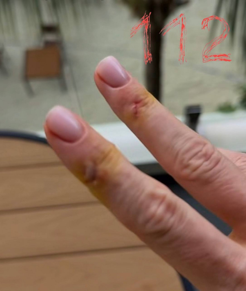 Мальдив аралдарындағы туристік нысанда акула шабуыл жасады