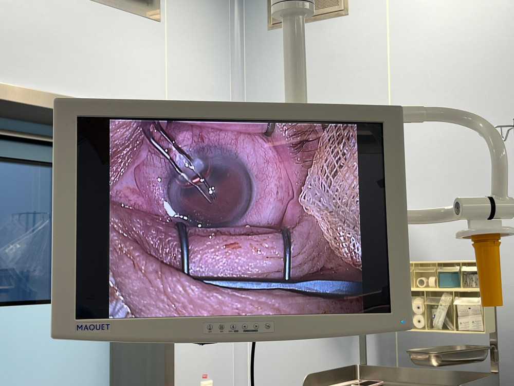 Дәрігер: Глаукома – көру қабілетіне төнген үнсіз қауіп