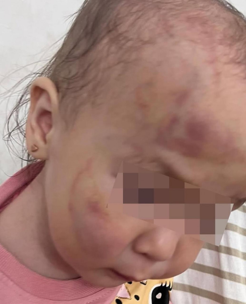 Ақтаудағы балабақшада бүлдіршінді қатыгездікпен соққыға жыққан