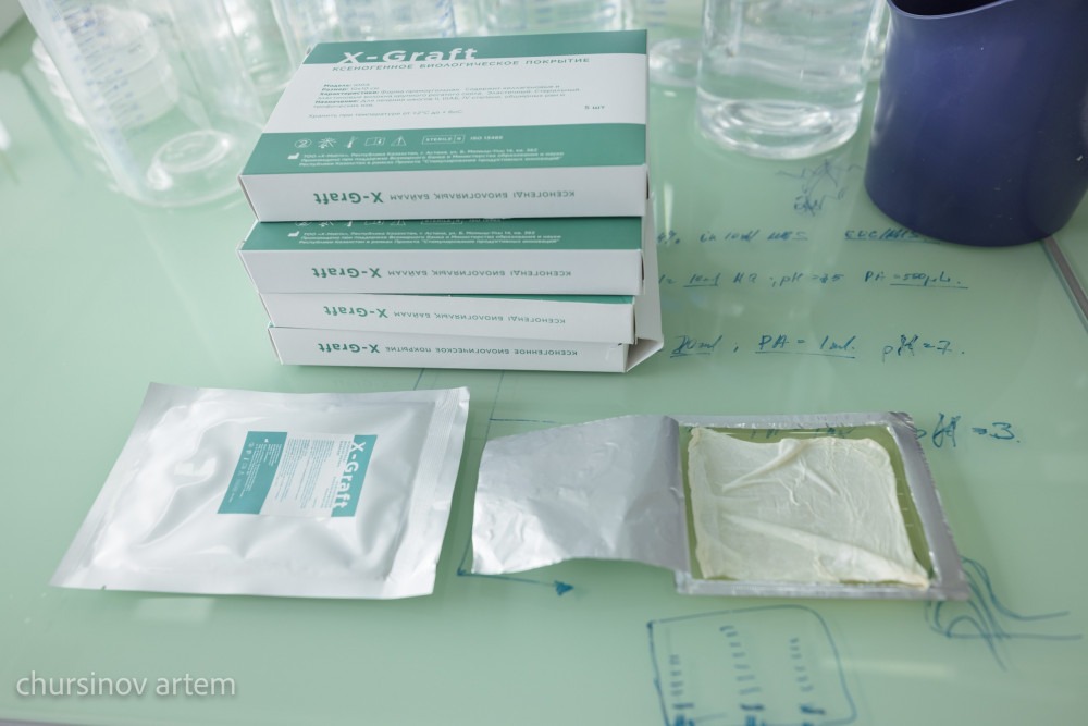 Қазақстандық дәрігерлер қатерлі ісікті емдеуде жаңа әдіс ойлап тапты